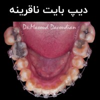 دیپ بایت ناقرینه | دکتر داودیان
