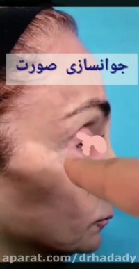 فیلم جالبی از جوانسازی صورت
