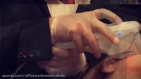 هایفو اولتراپی در کلینیک دکتر نیلفروش زاده