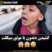 کشیدن دندون با موتور 1000