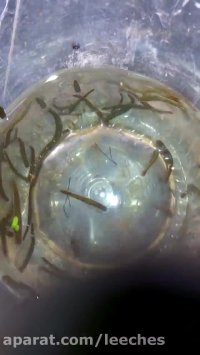 مطب زالو درمانی