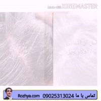 برای شوره سر چیکار کنیم ؟