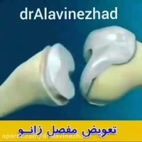 جراحی تعویض مفصل زانو