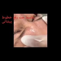 آموزش میکرونیدلینگ،آموزش مزووایت،آموزش مزونیدلینگ،موسسه ایران زمین