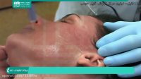 آموزش پاکسازی پوست صورت | درمان جوش صورت 02128423118