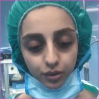 نمونه کار جراحی بینی دکتر کاظم زرگری