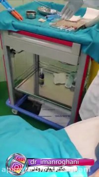 فیلم تزریق چربی به صورت