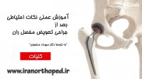 کلیات نکات احتیاطی بعد از یک جراحی تعویض مفصل ران