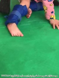 کاردرمانی کودکان فلج مغزی در تهران کلینیک مهسا مقدم