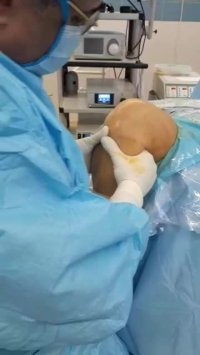 فیلم پزشکی ترمیم رباط صلیبی دکتر حبیب رشادی