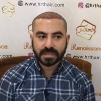 کاشت مو کلینیک تخصصی رنسانس