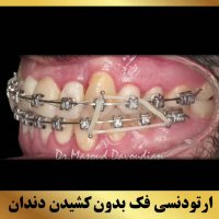 دکتر داودیان | متخصص ارتودنسی