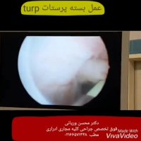فیلم عمل جراحی بزرگی خوش خیم پروستات