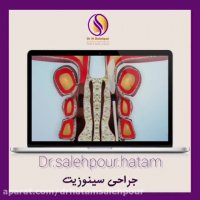 جراحی سینوزیت