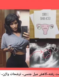 برای درمان نازایی داروی شیمیایی استفاده نکنید روش قطعی درمان پیش ماست