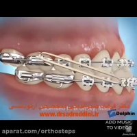 مراحل ارتودنسی