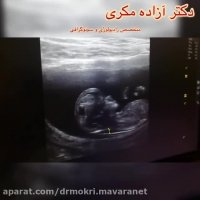 دکتر آزاده مکری متخصص رادیولوژی و سونوگرافی