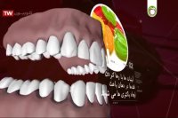 بهترین ها و بدترین ها برای سلامت دندان