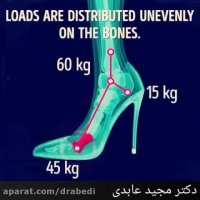 عوارض پوشیدن کفش نامناسب