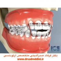 متخصص ارتودنسی در غرب تهران