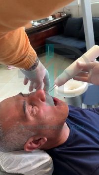 دستگاه Dento-Plasma شرکت دانش بنیان فن آوران سپید جامگان