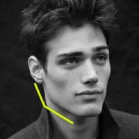 زاویه دهی فک بدون تزریق و جراحی