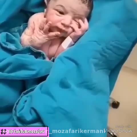 زایمان سزارین