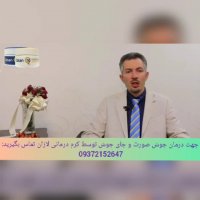 کرم لازان درمان قطعی جوش و جای جوش(رفع اکنه التهابات پوستی)