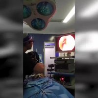 آندوسکوپی سینوس توسط دکتر شهریار یحیوی