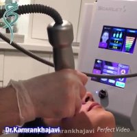 جوانسازی صورت با آر اف فرکشنال نیدلینگ