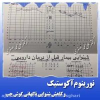 جراحی کاهش شنوایی ناگهانی گوش