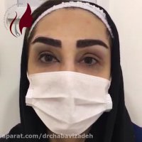 فیلم رضایت زیباجوی عزیز بعد از کاشت ابرو