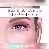 جوانسازی پوست با تزریق بوتاکس