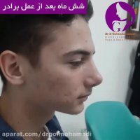 فیلم عمل بینی خواهر و برادر