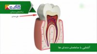 آشنایی با ساختمان دندان