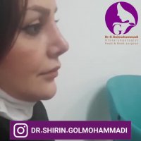 فیلم نتیجه عمل زیبایی بینی