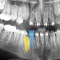 ارتودونسی شرق تهران | دکتر داوودیان