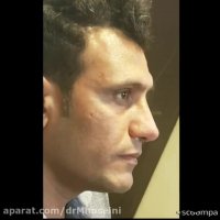 فیلم نمونه کار تیپ پلاستی دکتر محمدعلی حسینی
