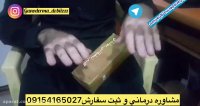 رفع مشكلات كبدي و پوستي٠٩١٥٤١٦٥٠٢٧