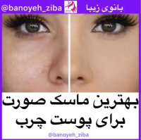 ماسک پوست چرب@banoyeh_ziba