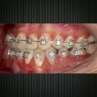 ارتودنسی شمال تهران | متخصص ارتودنسی