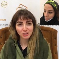 کاشت ابرو طبیعی کلینیک رنسانس