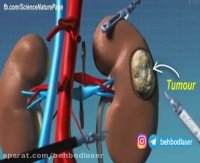 آینده جراحی ها به دست ربات های هوشمند