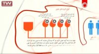 چیزهایی که درباره اهدای خون باید بدانید