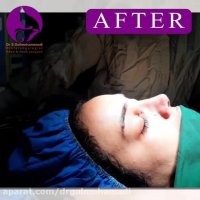 فیلم عمل زیبایی بینی