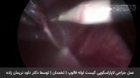 فیلم عمل جراحی لاپاراسکوپی کیست لوله فالوپ یا تخمدان توسط دکتر داود نریمان زاده