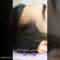 اسکالپ سه بعدی