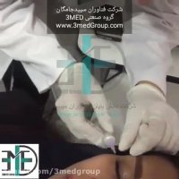 کربوکسی تراپی فن آوران سپیدجامگان