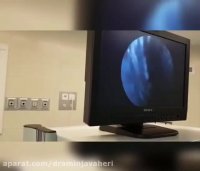 درمان پارگی رباط صلیبی زانو با آرتروسکوپی