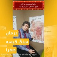 درمان سنگ کیسه صفرا